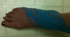 Foot with blue tape